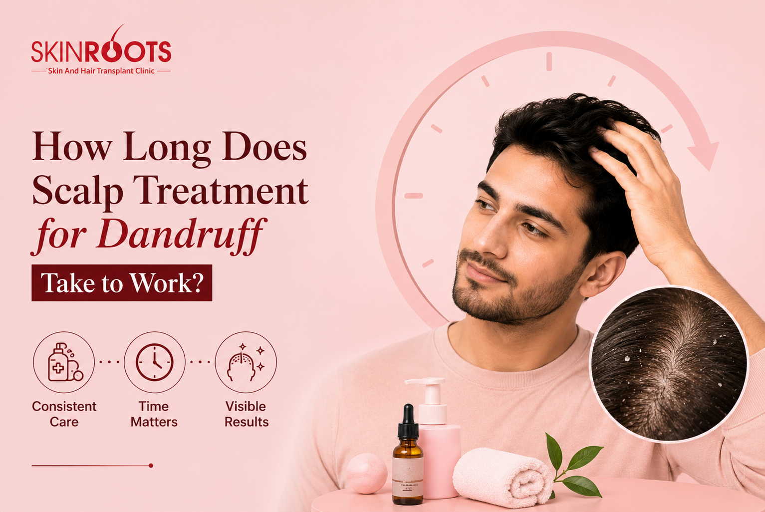 How Long Does Scalp Treatment for Dandruff Take to Work?